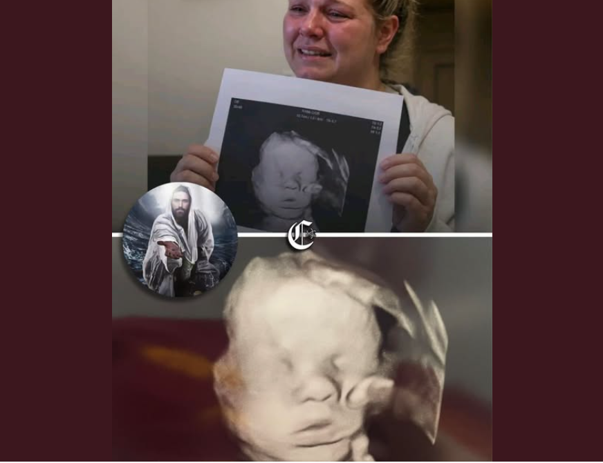 Testimonio: Dios puso Su mano sobre su bebé por nacer